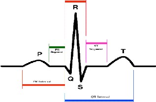 DESIGN AND IMPLEMENTATION OF ECG TELEMETRY SYSTEM BASED ON ZigBee