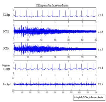 sampling journal data for Techniques Storage Compression Data Signal ECG and