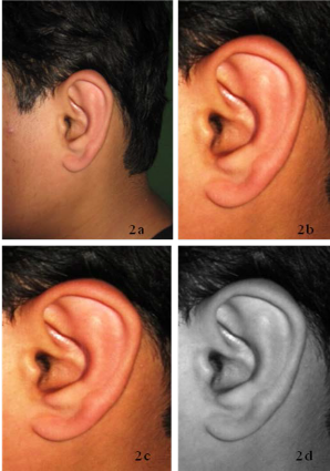 Ear Biometric: Sex, Bilateral and Ethnic Differences Among Brahmin and ...